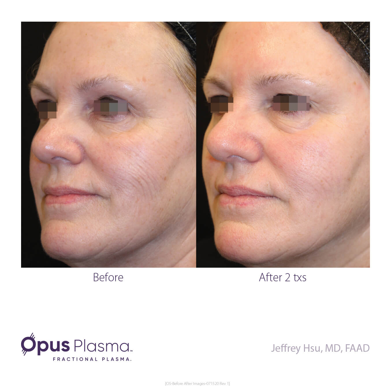 Opus-Before_and_After-B2C-4.jpg