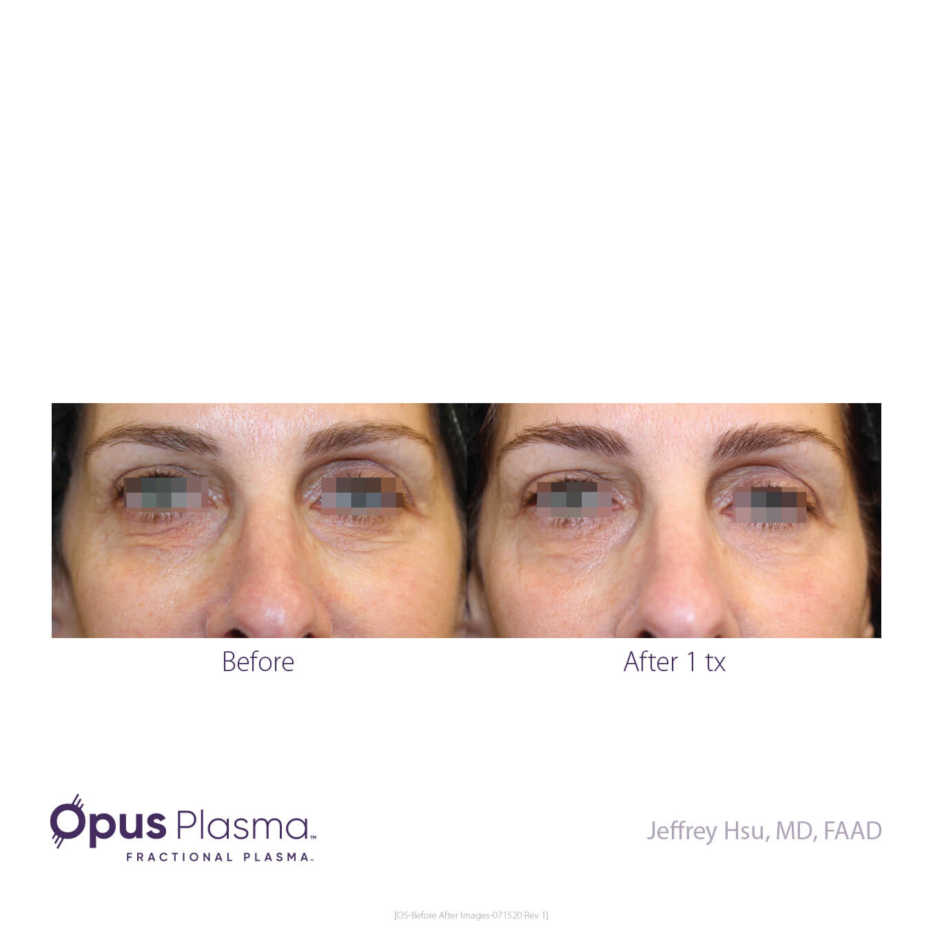 Opus-Before_and_After-B2C-6.jpg